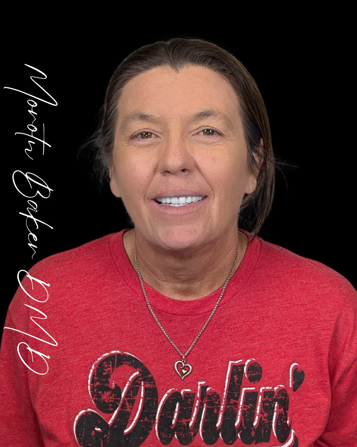 Holly, a real Dr. Baker patient, after new dentures