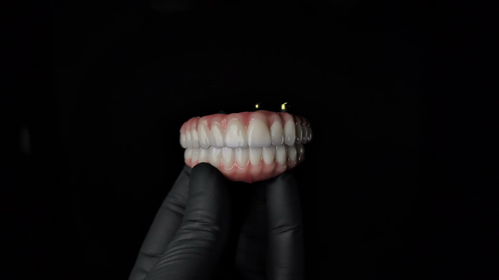 A patient with new fixed implant teeth