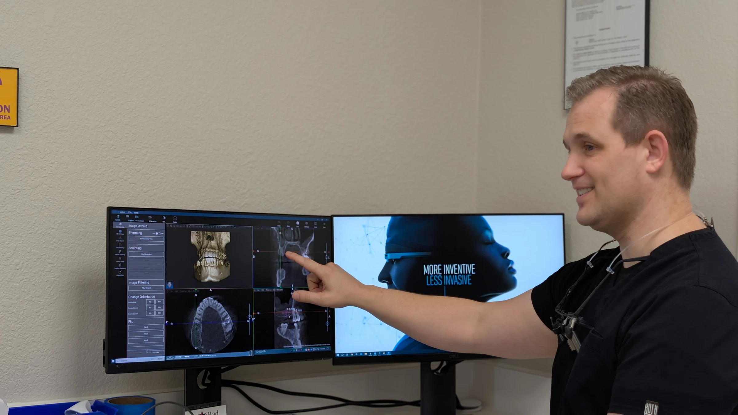 Dr. Baker pointing at a 3D CBCT scan on the imaging workstation
